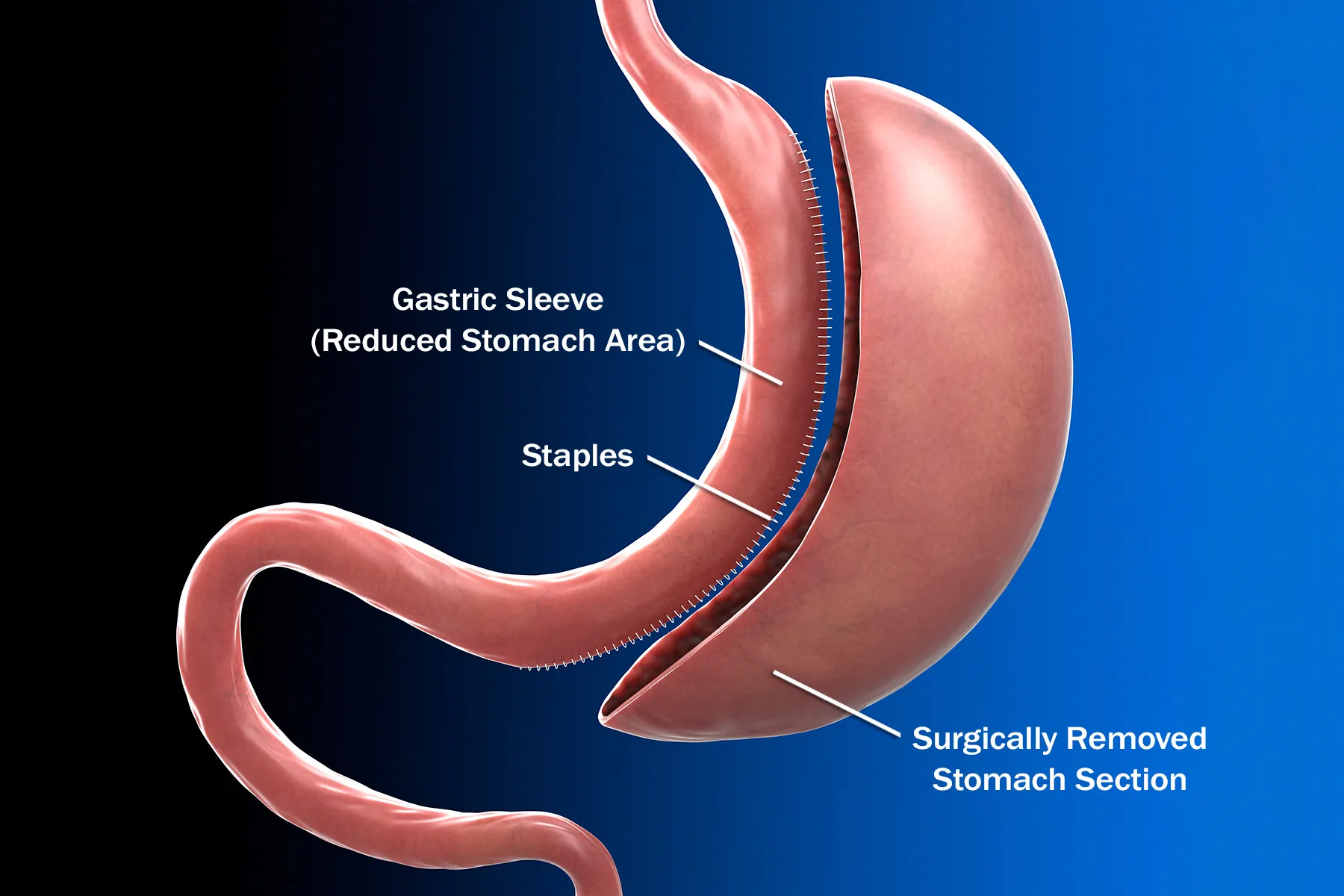 Happy Patient After Surgery